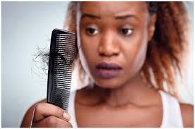 A dermatologist dispels the black don't crack myth. Everything You Need To Know About Hairloss As A Black Woman Truelove