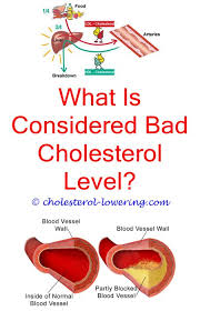 Pin On Symptoms Of High Cholesterol