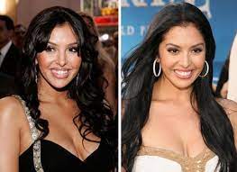 Vanessa bryant asks judge for quick action. 13 Celebs Before And After Plastic Surgery Celebrities Before And After Plastic Surgery Pictures Plastic Surgery