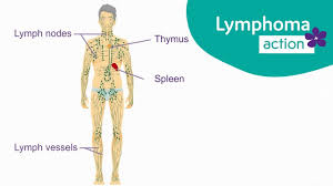 Knowing more about cancer and how it's treated can take some of the fear away. Lymphoma Action What Is Lymphoma