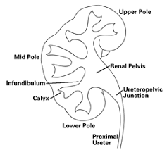 Kidney Lower Pole Calyx Kidney Kidney Stones Pole