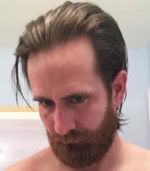 Visibility of the scalp is a common symptom of a receding hairline. 40 Best Haircuts For A Receding Hairline The Right Hairstyles