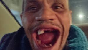 Fundraiser for David Thurston by Edward Thurston : Support David's Dental  Recovery