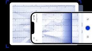 Image result for Electrocardiogram Validity