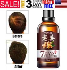 Hair restore biotin hair growth serum is the powerful hair oil which reduces the appearance of thinning, and hair loss. Tssplus Hair Regrow Essential Oils 7 Day Ginger Germinal Serum Essence Hair Oil Ginger Ginger Oil Hair Regrow Hair Oil For Women Germinal Ginger Oil Nutrient Hair Oil 7 Day Hair Tonic Regrow Hair Solution Kings Ginger Ginger King Solution For