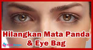 Mata panda atau lingkaran di bawah mata mata panda dapat dihilangkan dengan cara sederhana, antara lain memperbaiki jam tidur, mengompres mata, mencukupi kebutuhan. Punca Dan Cara Hilangkan Eye Bag Lingkaran Gelap Bawah Mata