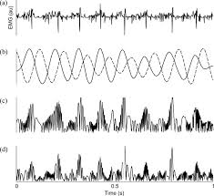 The most common pathologic tremor is essential tremor. A Simulated Surface Emg B Full Line Estimated Tremor Component Download Scientific Diagram