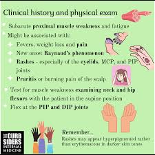 Image result for Myopathy