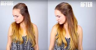 Receding hairline in women receding hairline on women related image of women s hairstyles to hide balding luxury african american women receding hairline and temples restoration. How To Hide Recession In Your Hair Line Cute Diy Projects