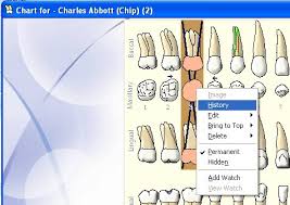 Tooth History In Chart
