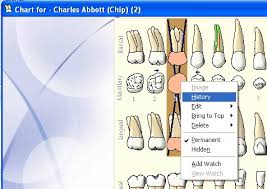 tooth history in chart