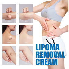 Lipoma Cream with Plant Extracts Quick Effect Fat Lump Removal Treatment Easy to Use 20G/0.7oz | Buy Now with Express International Delivery | GoSupps.com