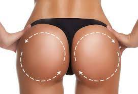 Liposuction will be used to collect fat deposits from unwanted areas on the body, the fat will be purified, and then injected into the patient's buttocks for natural. Brazilian Butt Lift Po Vergrosserung Mit Eigenfett