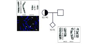 pedigree chart and cytogenetic analysis the left figure