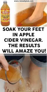 Soak Your Feet In Apple Cider Vinegar The Results Will Amaze You Apple Cider Vinegar Foot Soak Apple Cider Vinegar Remedies Foot Soak Vinegar