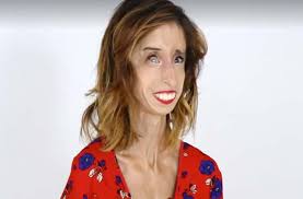 intro meuf, meuf, meuf bonne, bonne, bonne meuf. La Femme La Plus Moche Du Monde Explique Comment Elle A Appris A S Aimer