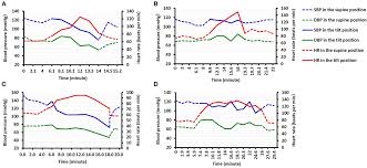 Image result for Head-Up Tilt-Table Testing