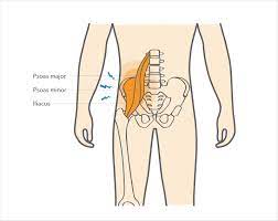 What causes hip flexor pain. Hip Flexor Strain Upswing Health