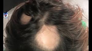 The bottle says to wash your hair with 10 to 15 pumps of the product, but a card that came in the box said that if you have long hair, you should use between 24 and 32 pumps. Hundreds Of Women Join Class Action Lawsuit Claiming Wen Hair Care Product Caused Hair Loss 5newsonline Com