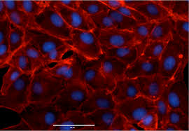 Nov 01, 2008 · vero cells are derived from the kidney of an african green monkey, and are one of the more commonly used mammalian continuous cell lines in microbiology and molecular and cell biology research. Vero Cell Based Vaccine Production Rabies And Influenza Cell Lines Media And Bioreactor Options Semantic Scholar