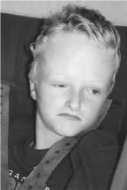 Patient 3 at the age of 14 years showing, turribrachycephaly, facial...