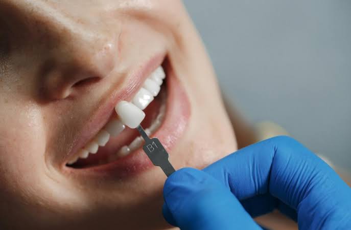 Zirconia Crowns product image