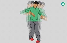 Image result for Ataxia