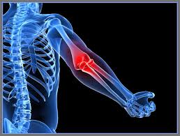 Kireclenme Tedavisi Icin Bitkisel Cozum Ve Tedavi Yontemleri