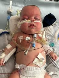 Matthew and Charlie have one early.