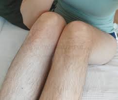 I am an african american woman and i have hair bumps and dark spots on my legs. Hairy To Smooth How Laser Hair Removal Changed My Life We Are Body Beautiful