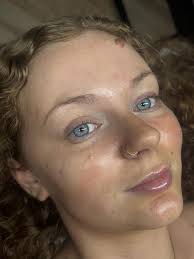 Riley Roberts l Licensed Esthetician (@rileyelisabethesthetics) • Instagram  photos and videos