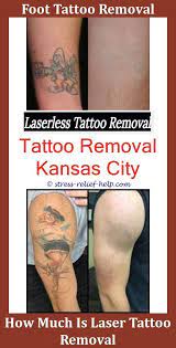 Hydrogen peroxide is another common household item that is used to remove permanent tattoos. How To Remove Permanent Tattoo From Body At Home Cheap Tattoo Removal Does Tattoo Removal Cream Actually Work How Kleine Tatowierungen Tatowierungen Diy Tattoo