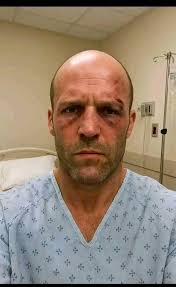 In need of support after injury