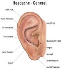 Ear Diagram Nogier Diagram Headache Piercing Daith
