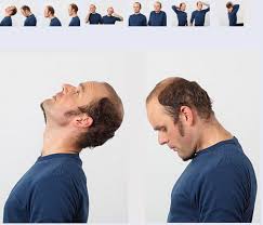 Eine echte herausforderung für den rücken. Physiotherapie Gelenk Klinik De