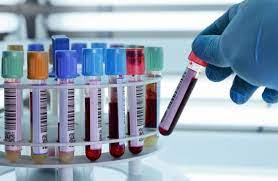 Maybe you would like to learn more about one of these? Exames Laboratoriais Para E Enfermagem