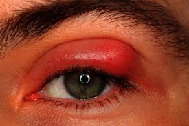 gozde cikan arpacik bu sayede geciyor