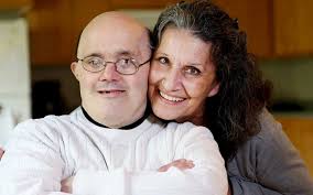 Down syndrome Archives