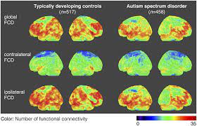 Autism spectrum disorder (asd) refers to a group of complex neurodevelopment disorders characterized by repetitive and characteristic patterns of behavior and difficulties with social communication and interaction. Frontiers Abnormalities Of Inter And Intra Hemispheric Functional Connectivity In Autism Spectrum Disorders A Study Using The Autism Brain Imaging Data Exchange Database Neuroscience