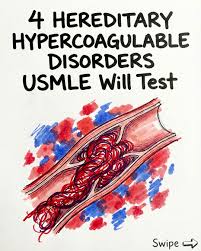 Image result for Hypercoagulable