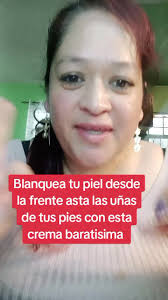 Funciona La Crema Aclarante Barles