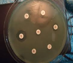 We did not find results for: Showing Mrsa On Muller Hinton Agar Download Scientific Diagram