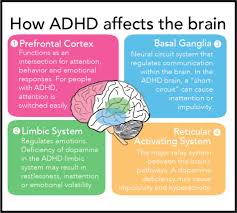 Learn more about the symptoms in children and adults, types, causes, diagnosis, testing, treatment. Opinion Misbranded And Misconceived Living With Adhd Is Different Than The Public Perceives The Appalachian