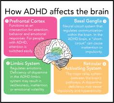 Overcome adhd & anxiety online. Opinion Misbranded And Misconceived Living With Adhd Is Different Than The Public Perceives The Appalachian