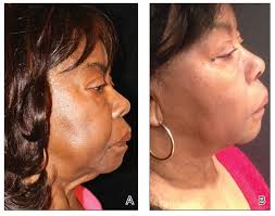 Diversity in Medicine