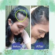 How To Stop Hair Fall @ Just Rs.199