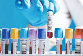Há um grande número de exames laboratoriais disponíveis comercialmente que têm utilidade na avaliação do paciente com suspeita de doença hepática ou na investigação da sua causa. Exames Laboratoriais Mc Service