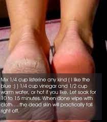 Mission Marriage Make My Feet Pretty Beauty Remedies Skin Remedies Feet Treatment