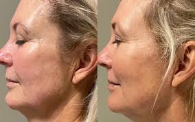 55 Plus of Rochester #83: September