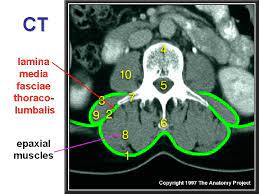 The back muscles are anatomically layered into superficial (extrinsic) and deep (intrinsic) muscles. Svaly Ii Muscles Ii Thorax Back Muscles Of
